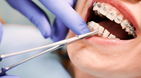 orthodontiste